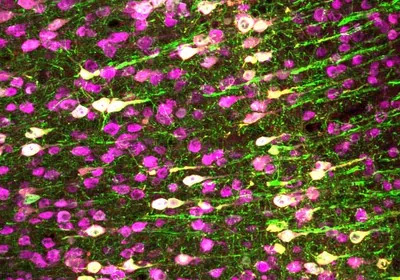 Histological stain of motor neurons in purple and green Histological stain of motor neurons in purple and green